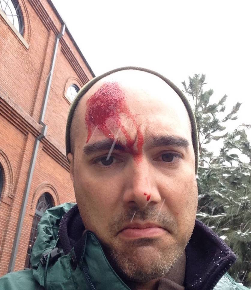 bear-bagging-casualty